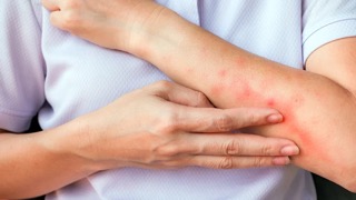 Best Mosquito Control Service in Marietta, GA